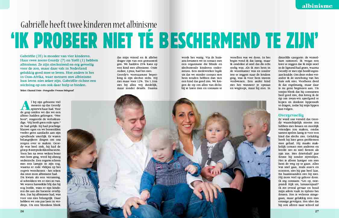 kinderen met albinisme